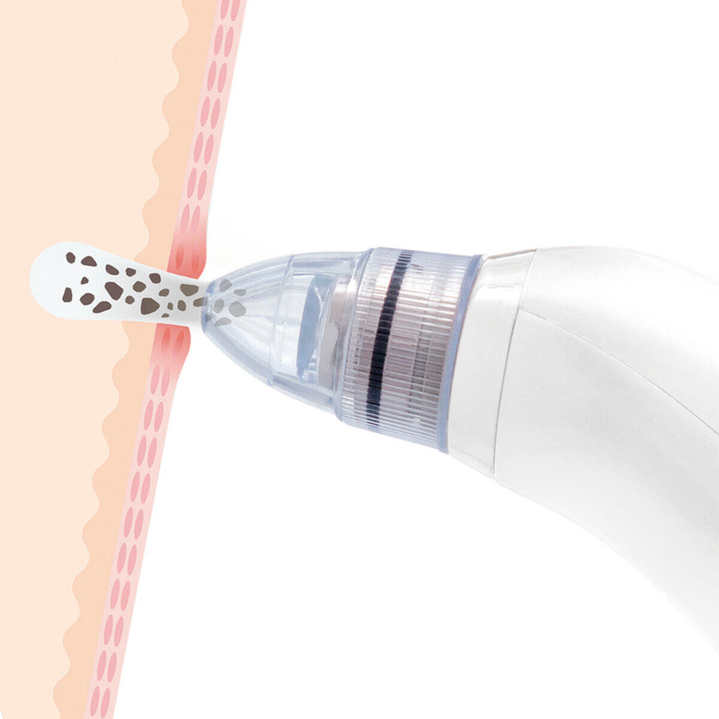 Limpiador Facial Eléctrico de Puntos Negros